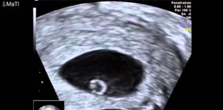 Gebeliğin/Hamileliğin 5. Haftası